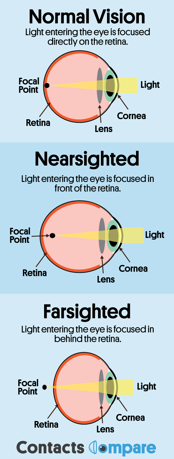 nearsighted vs farsighted